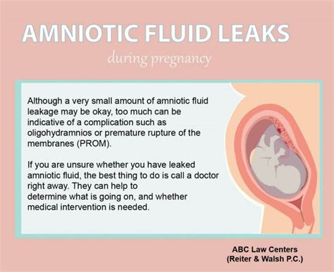 does leaking amniotic fluid smell|Leaking amniotic fluid: Signs and what to do